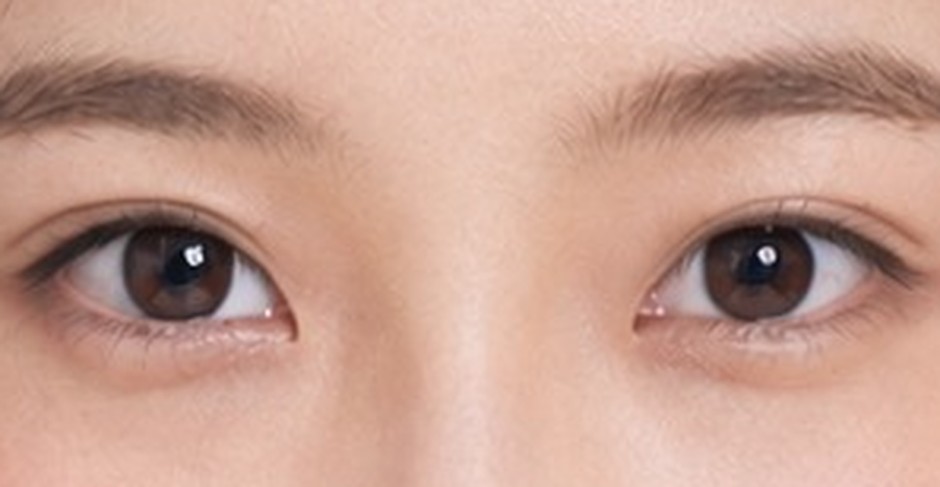 Close-up of eyes with a high crease line