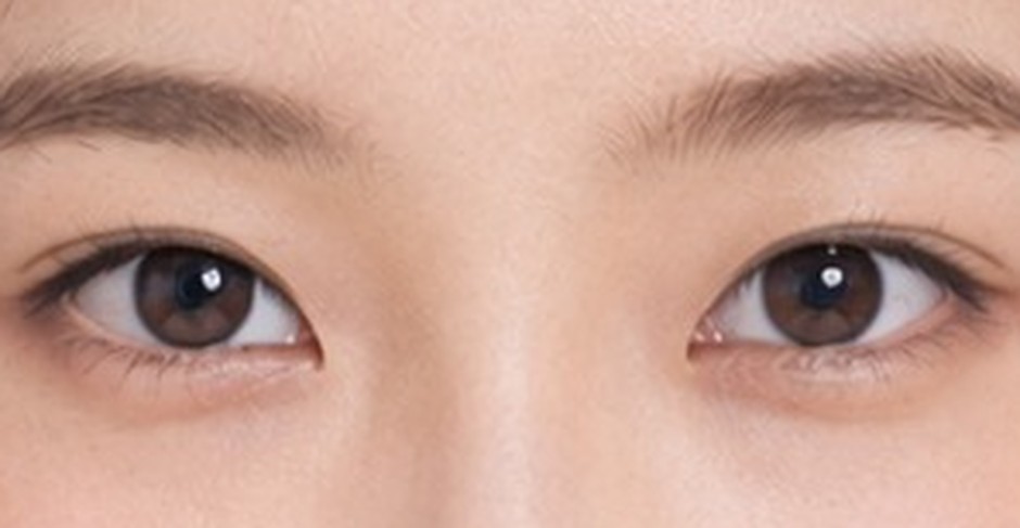 Close-up of eyes with a low crease line