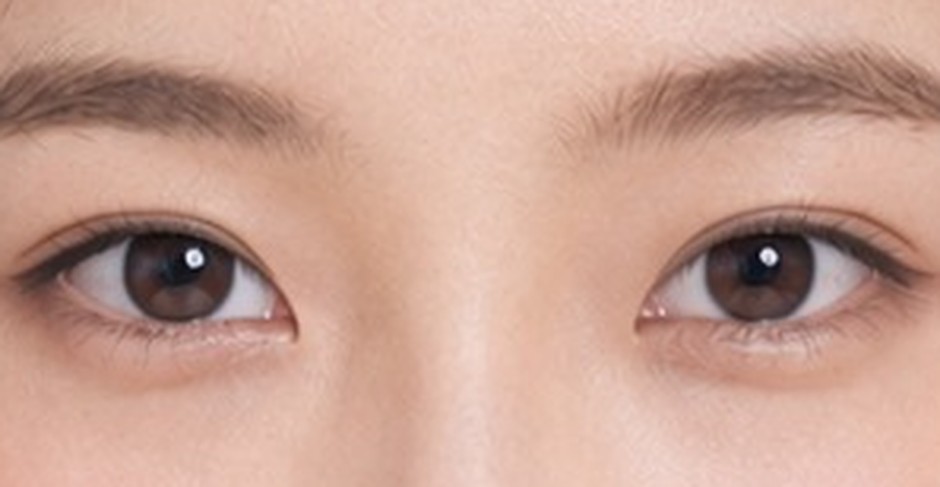 Close-up of eyes with a medium-height crease line
