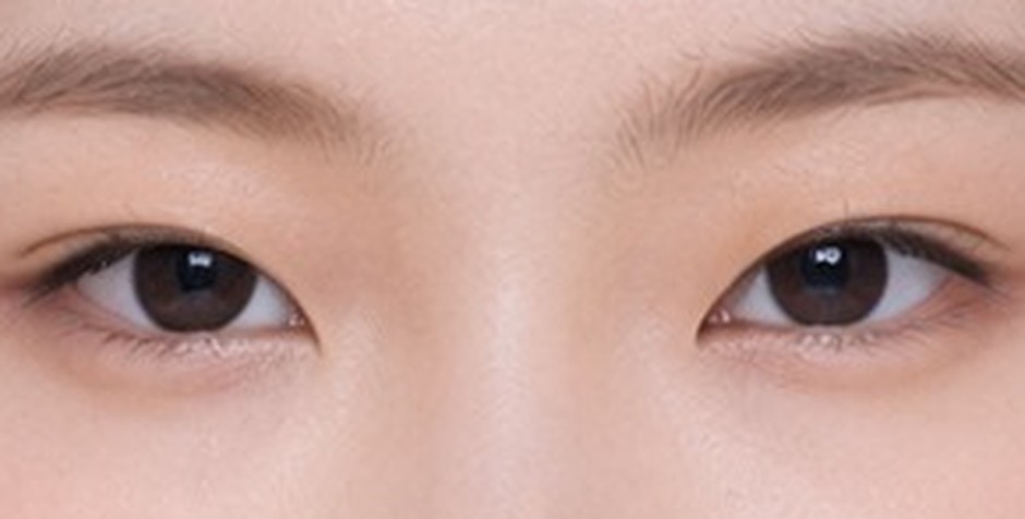 Strength 1 — A shallow line. Mostly hidden when the eyes open.