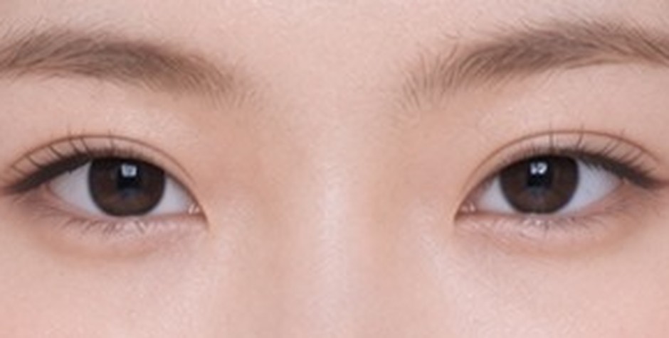 Strength 3 — The fold is widest and the eyes look largest.