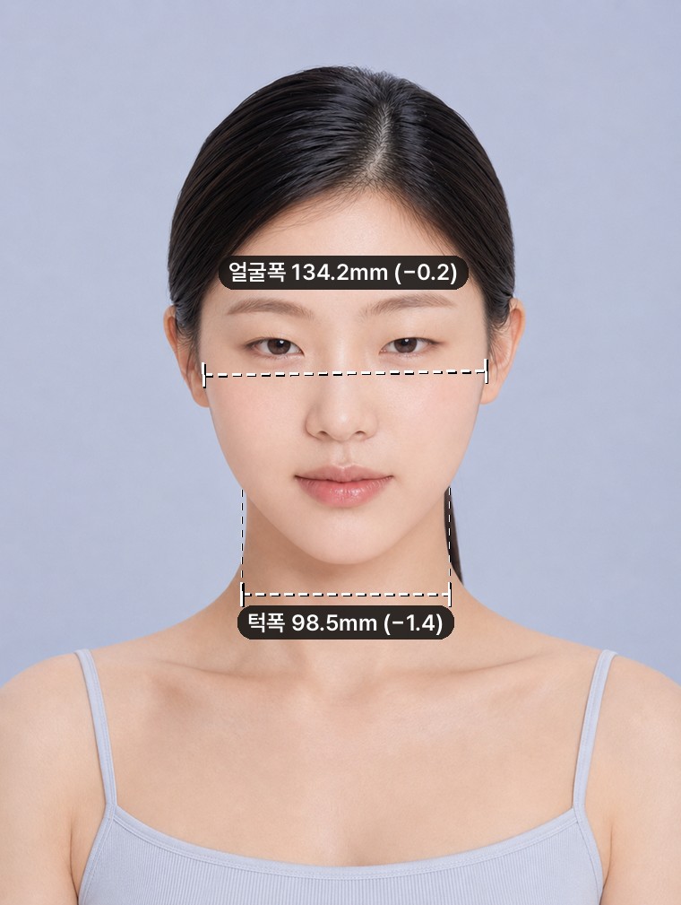 1. V-line — Jaw width −1.4mm. The length stays put.