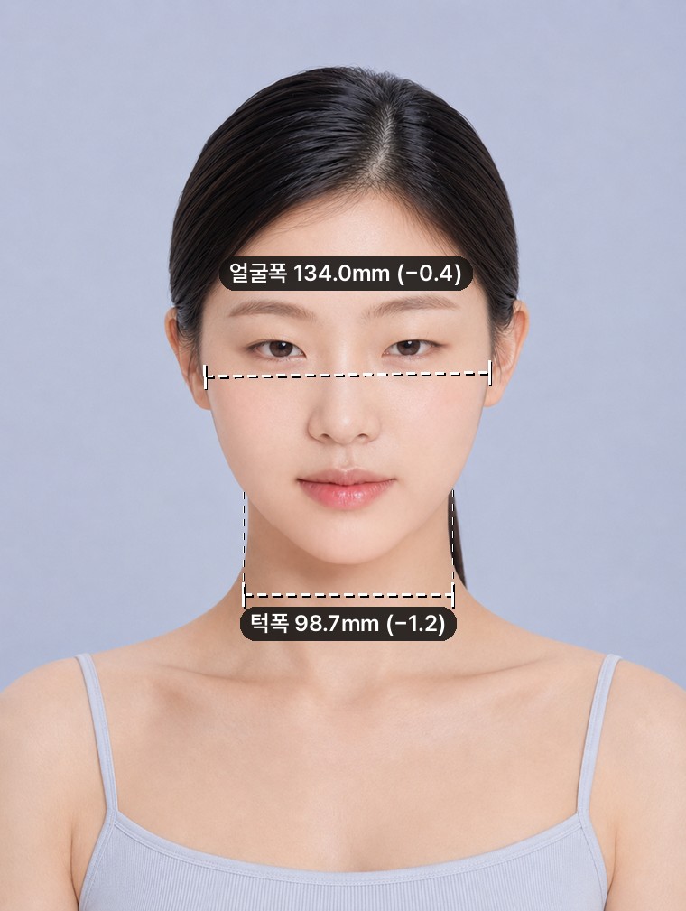 2. + Chin — Lower-face length −1.4mm. In exchange, the jaw-width reduction shrank to −1.2mm.